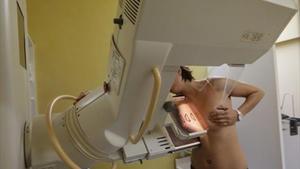 Una dona se sotmet a una mamografia per radiografiar-li l’estat del pit.