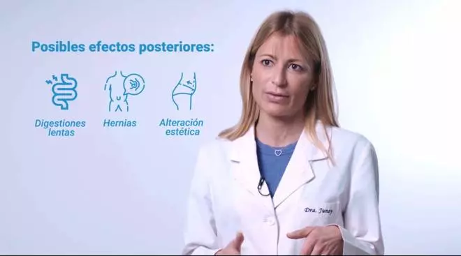 ¿Qué es la diástasis abdominal o de rectos? ¿es peligrosa? ¿se puede operar?