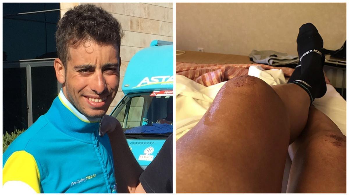 El ciclista italiano Fabio Aru y su maltrecha rodilla.