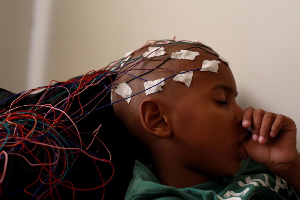 Ismael Blanco, de 6 años, un paciente neurológico, se chupa el dedo mientras duerme durante un electroencefalograma en La Guaira, Venezuela.