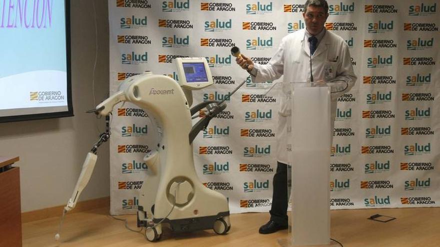 La unificación de la radioterapia llevará técnicas innovadoras a todo Aragón