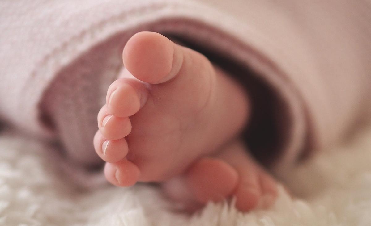 El pie zambo es una deformidad en recién nacidos que se puede corregir