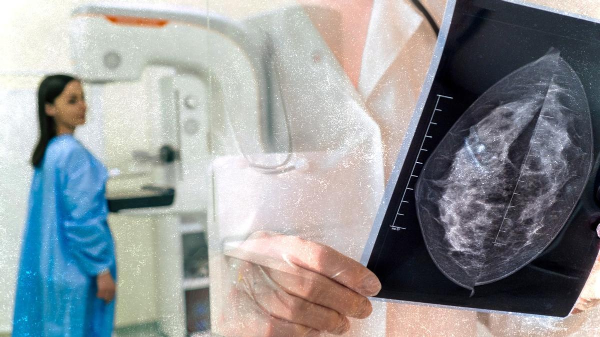 El testimonio de una asturiana con cáncer de mama: "Perdí dos meses de oro para tratar mi tumor"