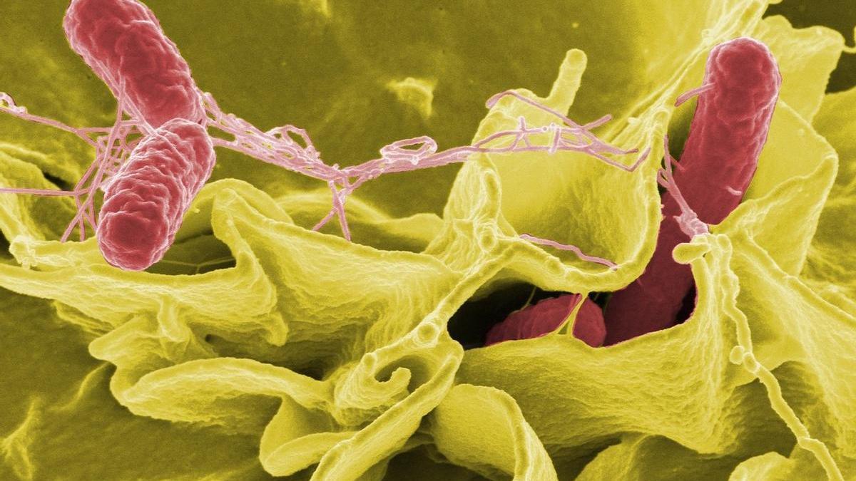 Bacterias de salmonela vistas desde un microscopio.