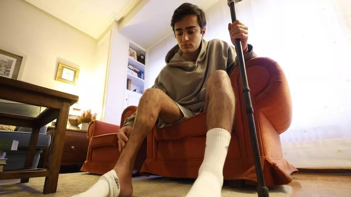 El joven Juan Milans del Bosch muestra la pierna afectada con una evidente pérdida de masa muscular.