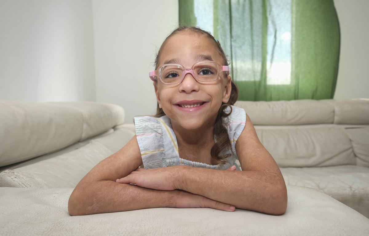 Briana Trujillo, la pequeña canaria con una enfermedad rara en la piel