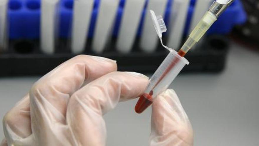 La vacuna española contra el VIH logra un éxito del 90%