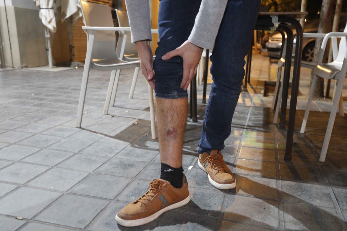 La víctima de la agresión enseña algunas de sus heridas