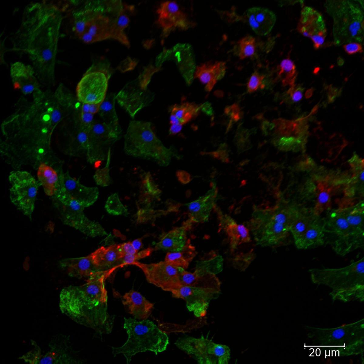 Hemocitos. Células inmunes de mexillón.
O núcleo está marcado en azul e o citoplasma en verde. Marcouse en vermello unha pequena proteína con función antibacteriana e antiviral que só teñen
os mexillóns (miticina).
