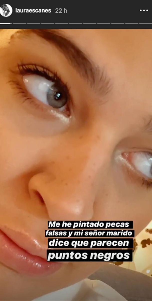 Laura escanes se hace pecas y risto dice que son puntos negros