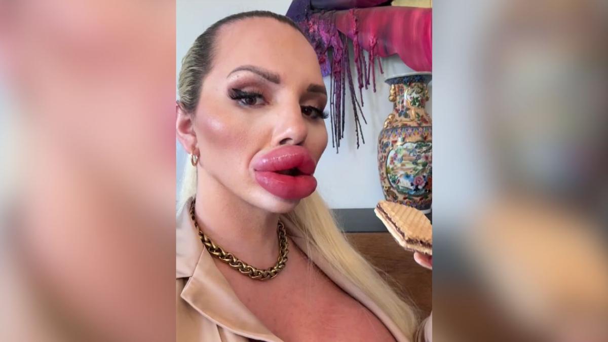 Quién Andrea Ivanova, la mujer que vive en Mallorca y asegura tener los labios más grandes del mundo