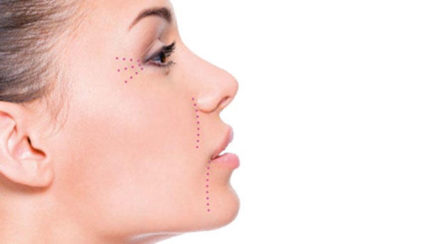 Rejuvenecimiento facial Centro Dermatológico Estético