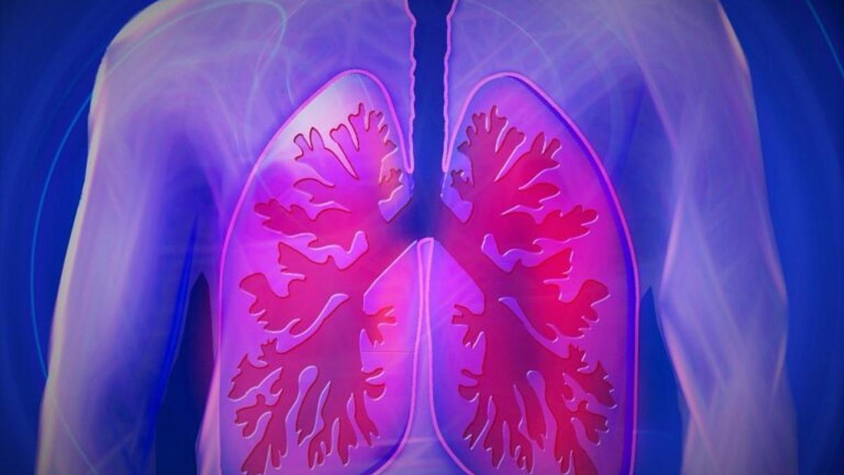 ¿Qué es la hipertensión arterial pulmonar?