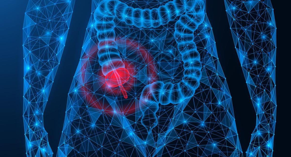 Recreació d'un abdomen inflamat.