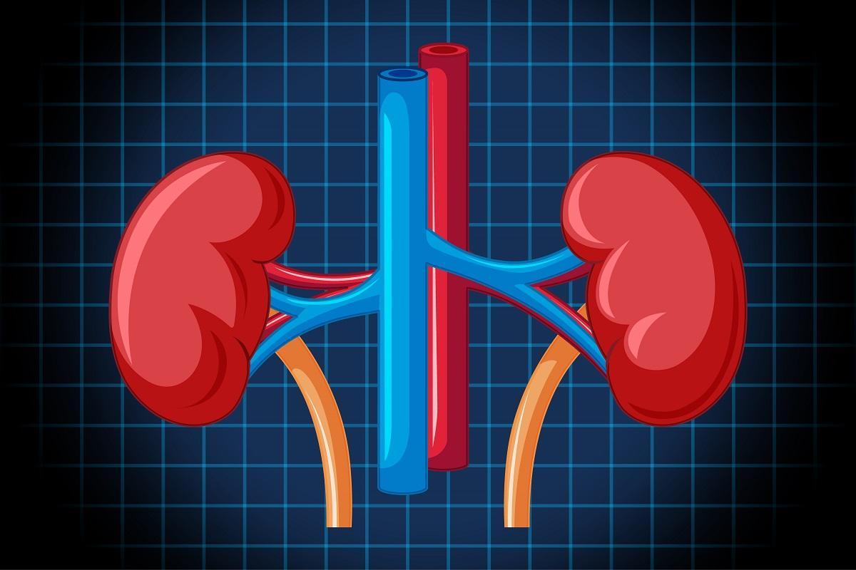 La litiasis puede provocar obstrucción de la vía urinaria, dando lugar a un cólico renal.