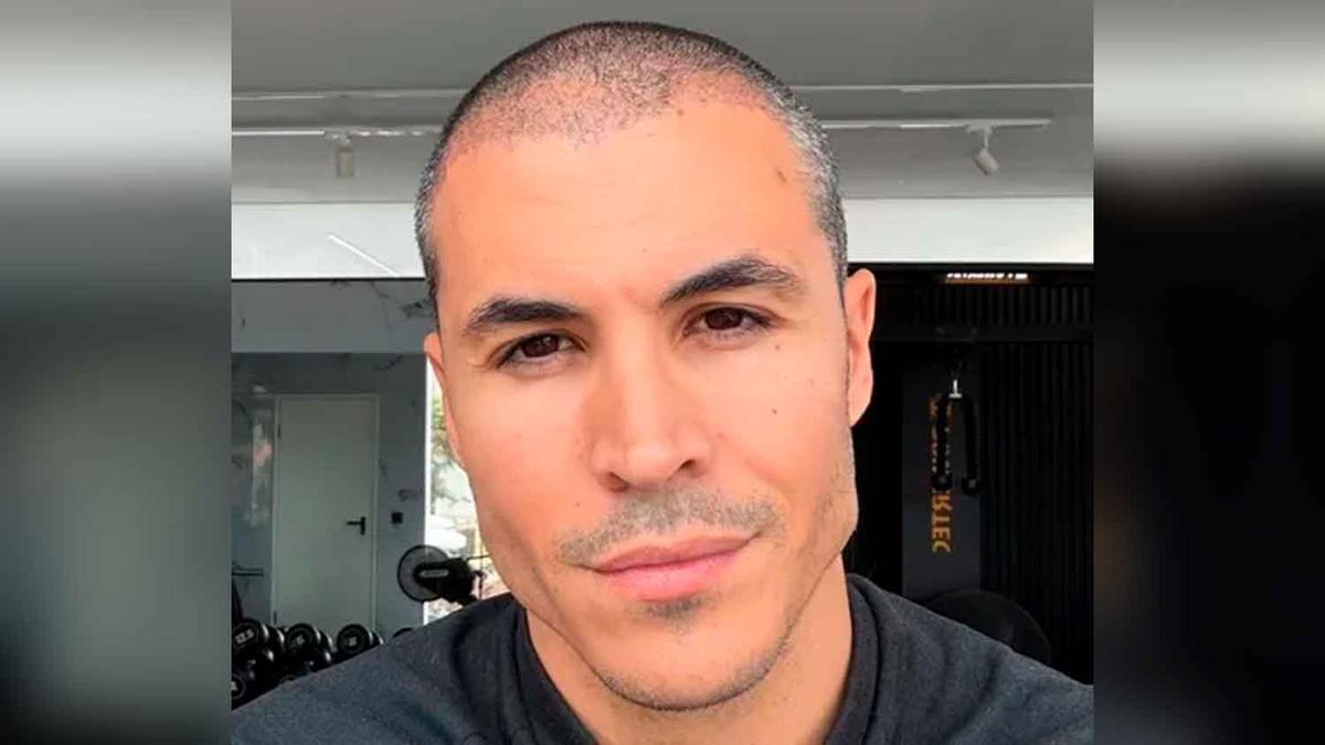 ¿Qué ha pasado con el novio de Sofía Suescun? El motivo de su drástica caída de pelo tras el "shock loss"