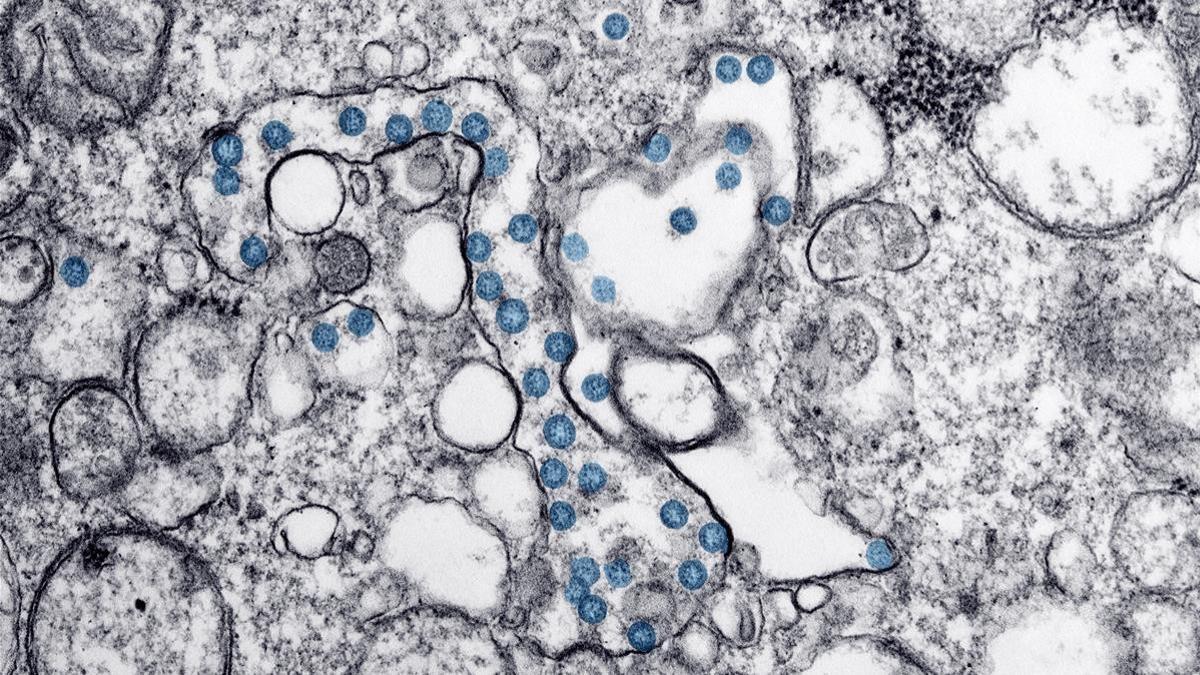 Investigadores del CSIC obtienen un nanomaterial que elimina el coronavirus y es aplicable en mascarillas y tejidos