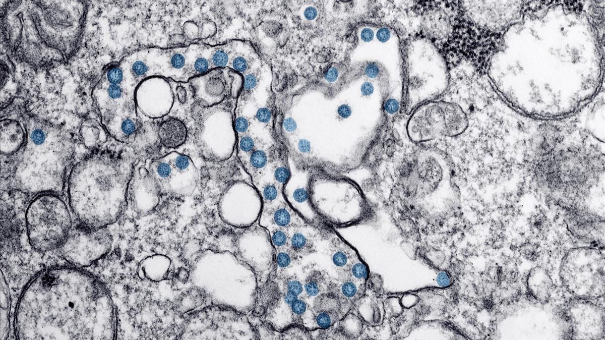 Investigadores del CSIC obtienen un nanomaterial que elimina el coronavirus y es aplicable en mascarillas y tejidos. Investigadores del CSIC obtienen un nanomaterial que elimina el coronavirus y es aplicable en mascarillas y tejidos.