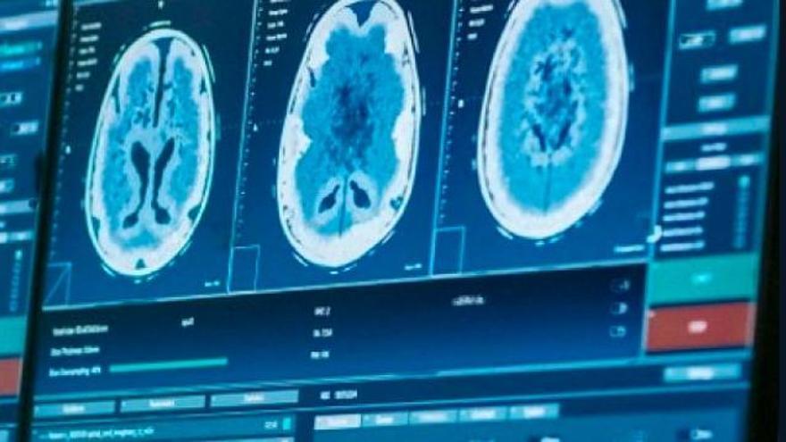 La biotecnológica gallega cierra una financiación total de 2,5 millones de euros