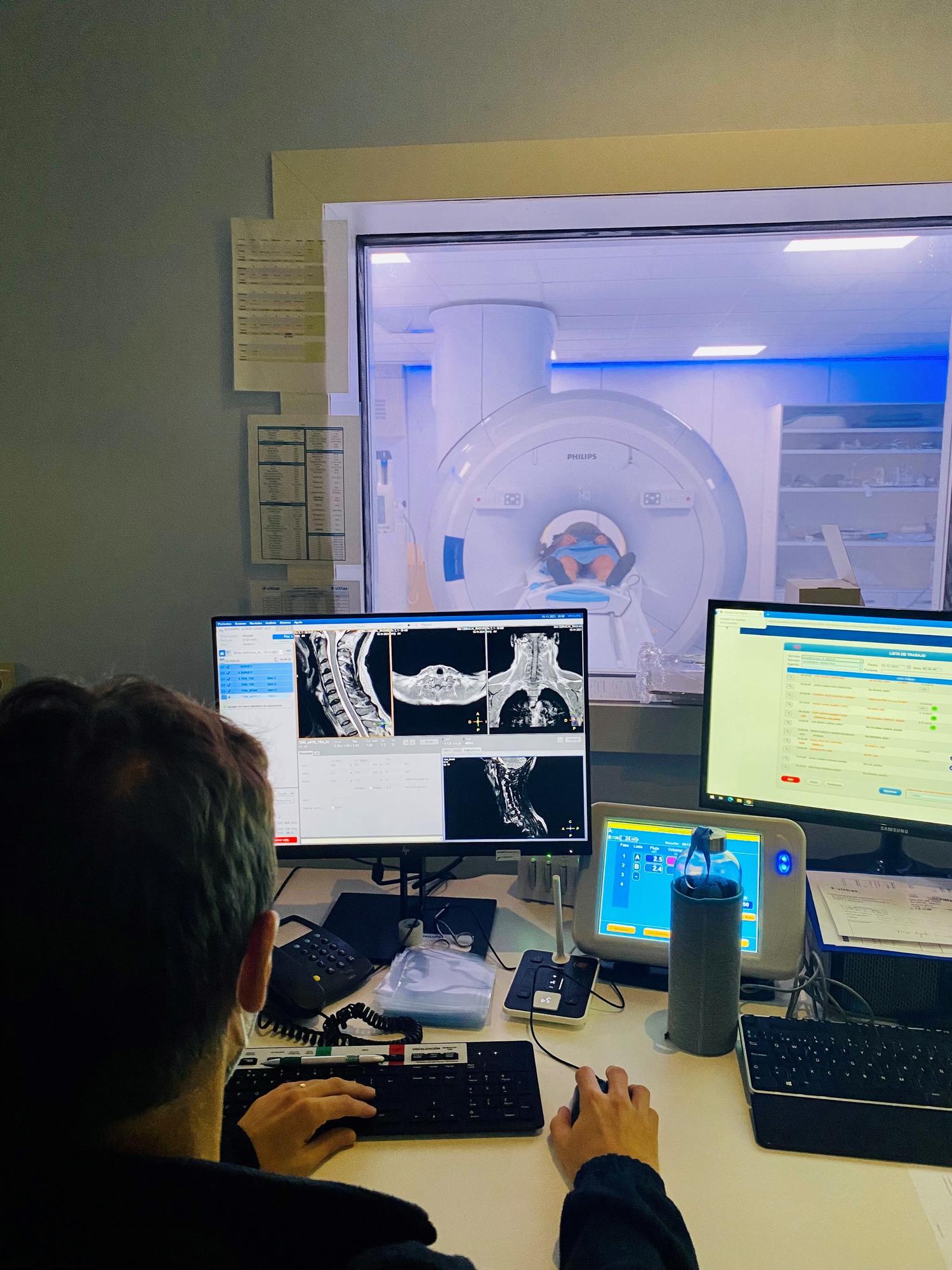 El último modelo de la Prodiva 1,5T está diseñado para obtener imágenes de calidad en áreas anatómicas tan complejas como la neurología, cardiología y oncología.