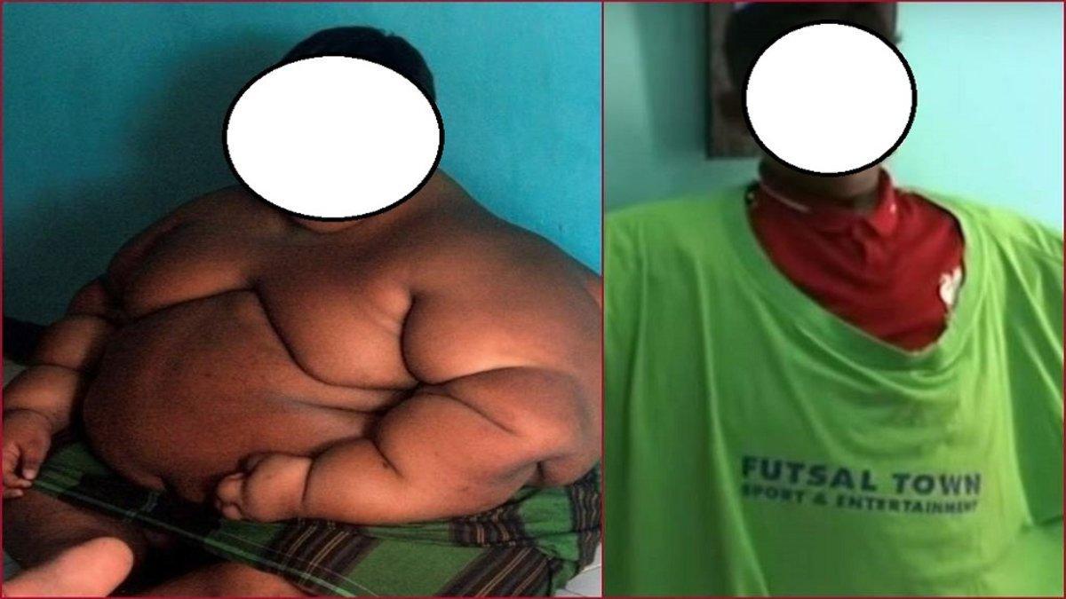 El impresionante cambio físico del 'Niño más gordo del mundo'