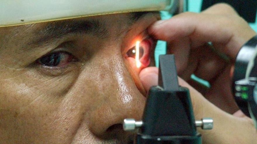 25.000 personas diagnosticadas de glaucoma podrían sufrir ceguera total