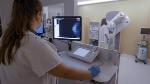Un tractament contra el càncer de mama redueix un 5% les recaigudes durant 8 anys