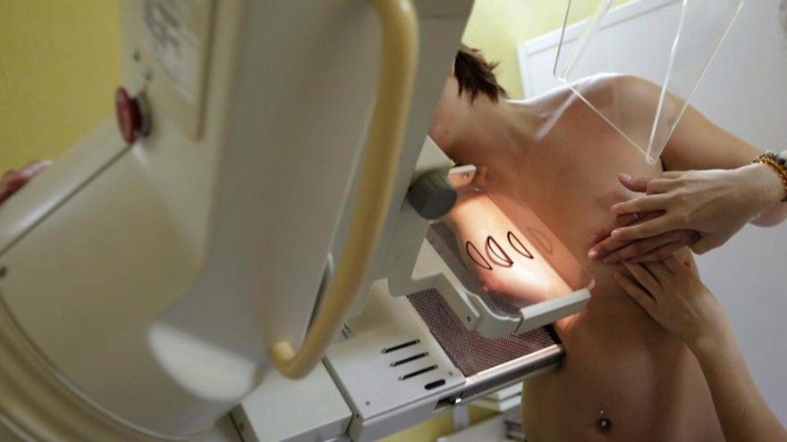 El cáncer de mama desplaza al de pulmón como el más común en el mundo