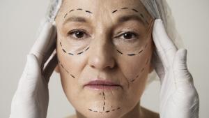 Edadismo: ¿Hay una tendencia creciente en la cirugía estética facial entre los mayores de 50 años?