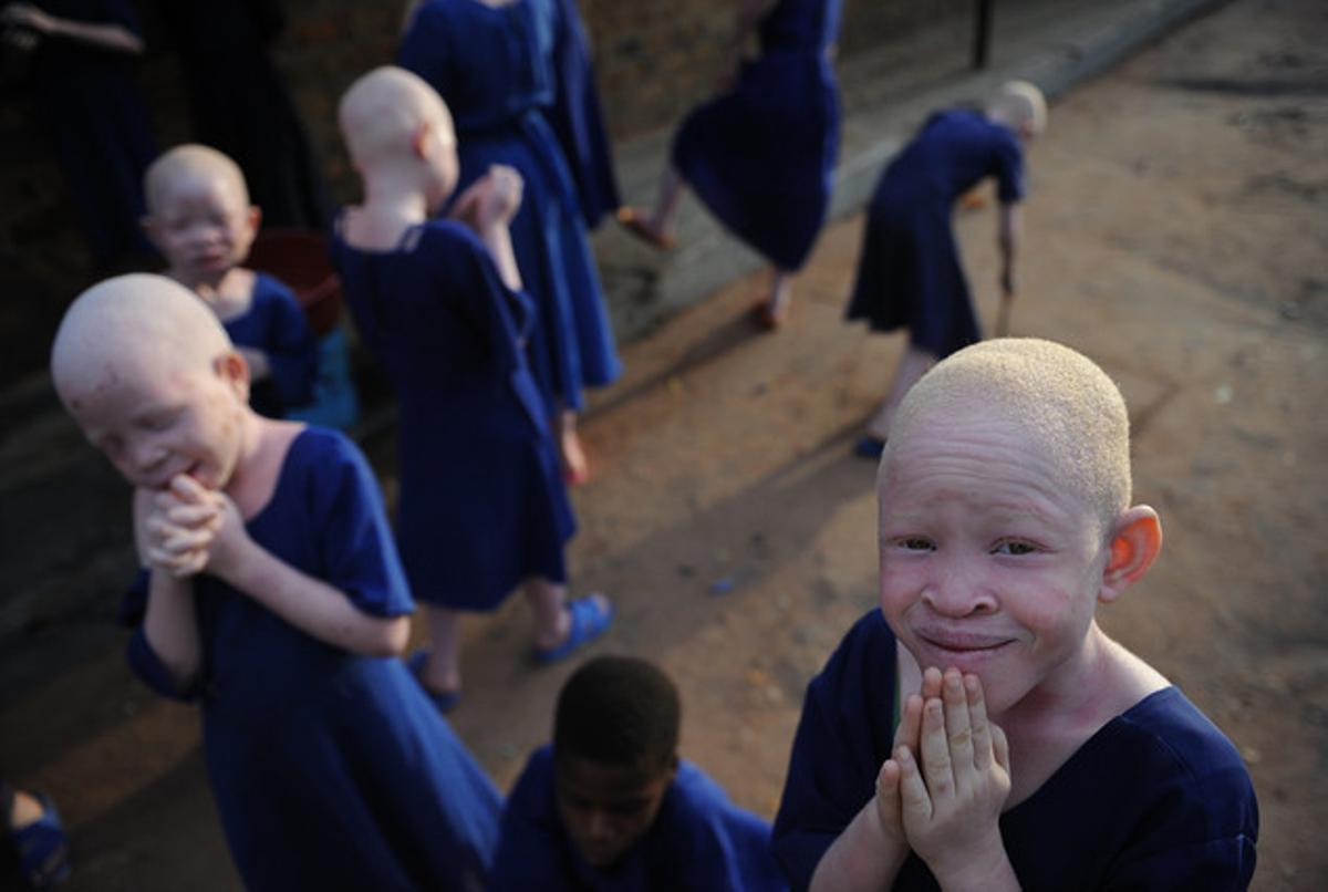 Centre on s’allotja i protegeix nens albins a Tanzània.