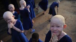 Centro donde se aloja y protege a niños albinos en Tanzania.