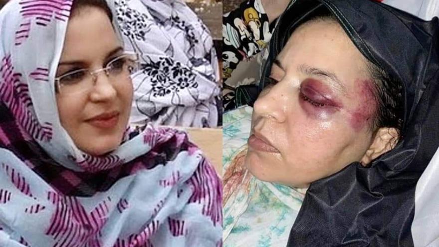 La activista saharaui antes y después de ser agredida por la policía marroquí.
