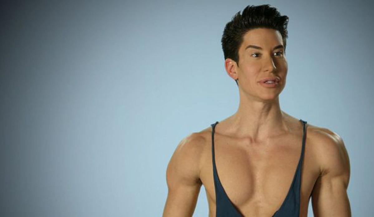 Los casos más impactantes de 'Chapuzas estéticas'