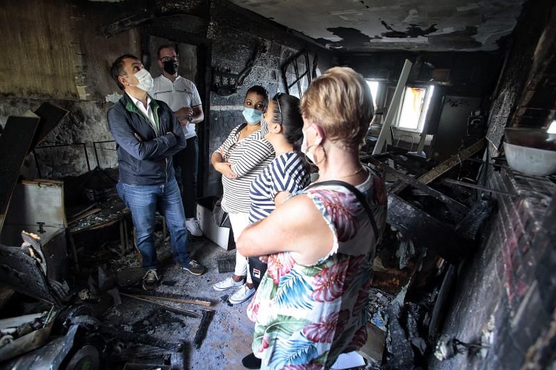 Bermúdez visita a los vecinos y familias de Añaza afectadas por el último incendio en las viviendas