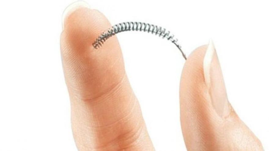 Afectadas por el anticonceptivo Essure llevan el caso a la Audiencia Nacional