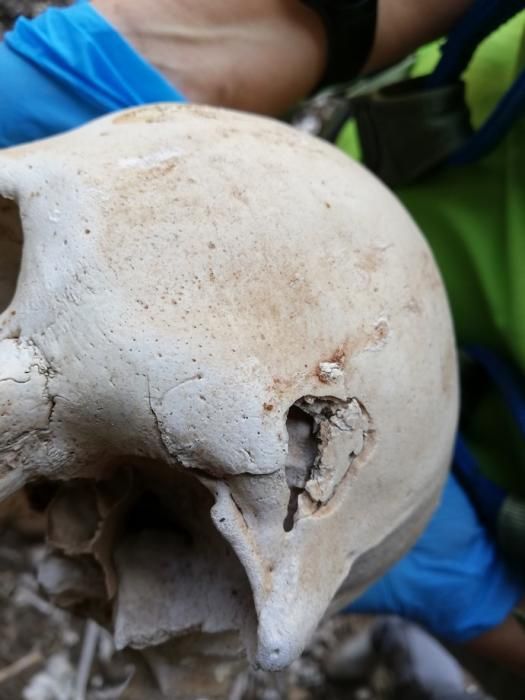 Estudios de restos óseos hallados en excavaciones prehispánicas en el sureste de Gran Canaria