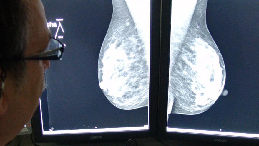 Un professional revisa una mamografia