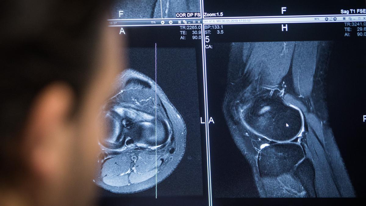 Traumatología en el Hospital de Manises