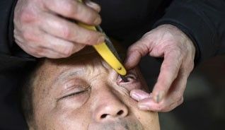 Un barbero usa una máquina de afeitar para limpiar el interior del párpado de un cliente siguiendo el servicio tradicional de peluquería chino