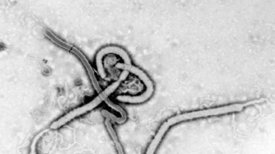 El virus de l&#039;Ebola