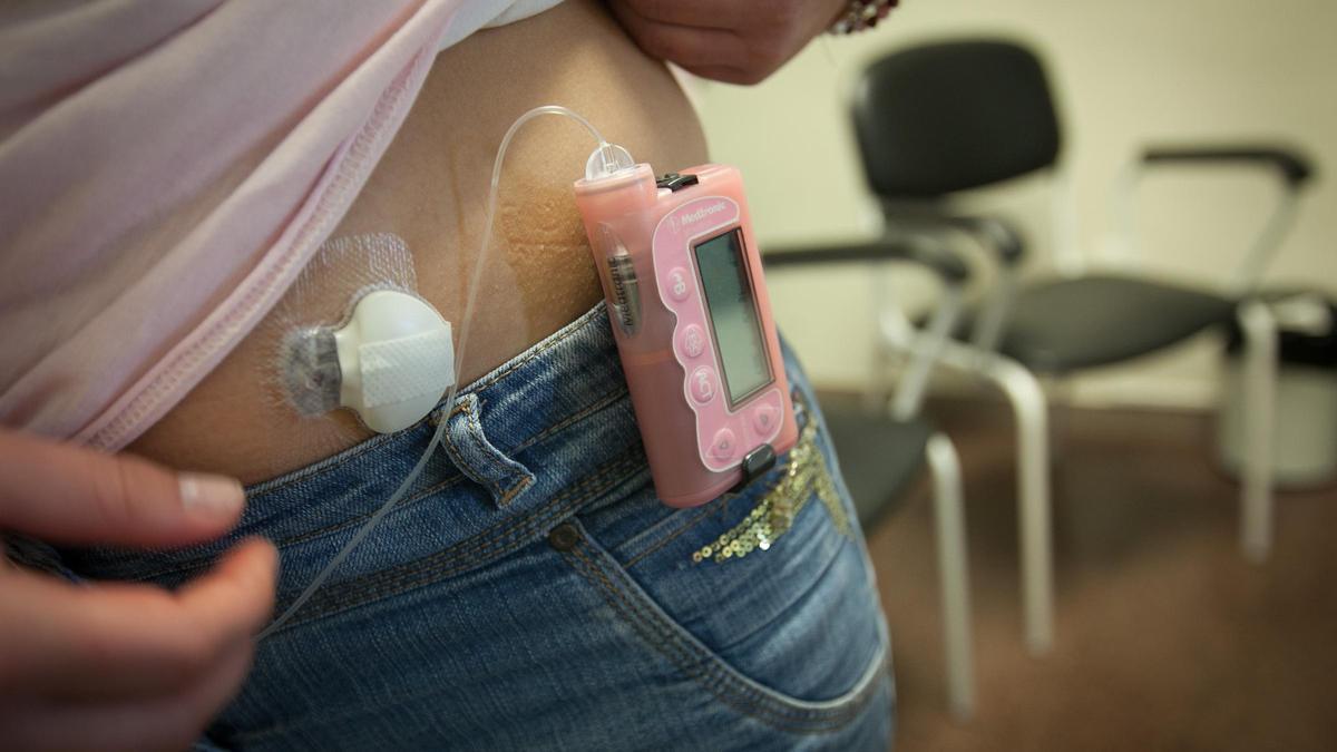 Bomba de insulina para niños diabéticos