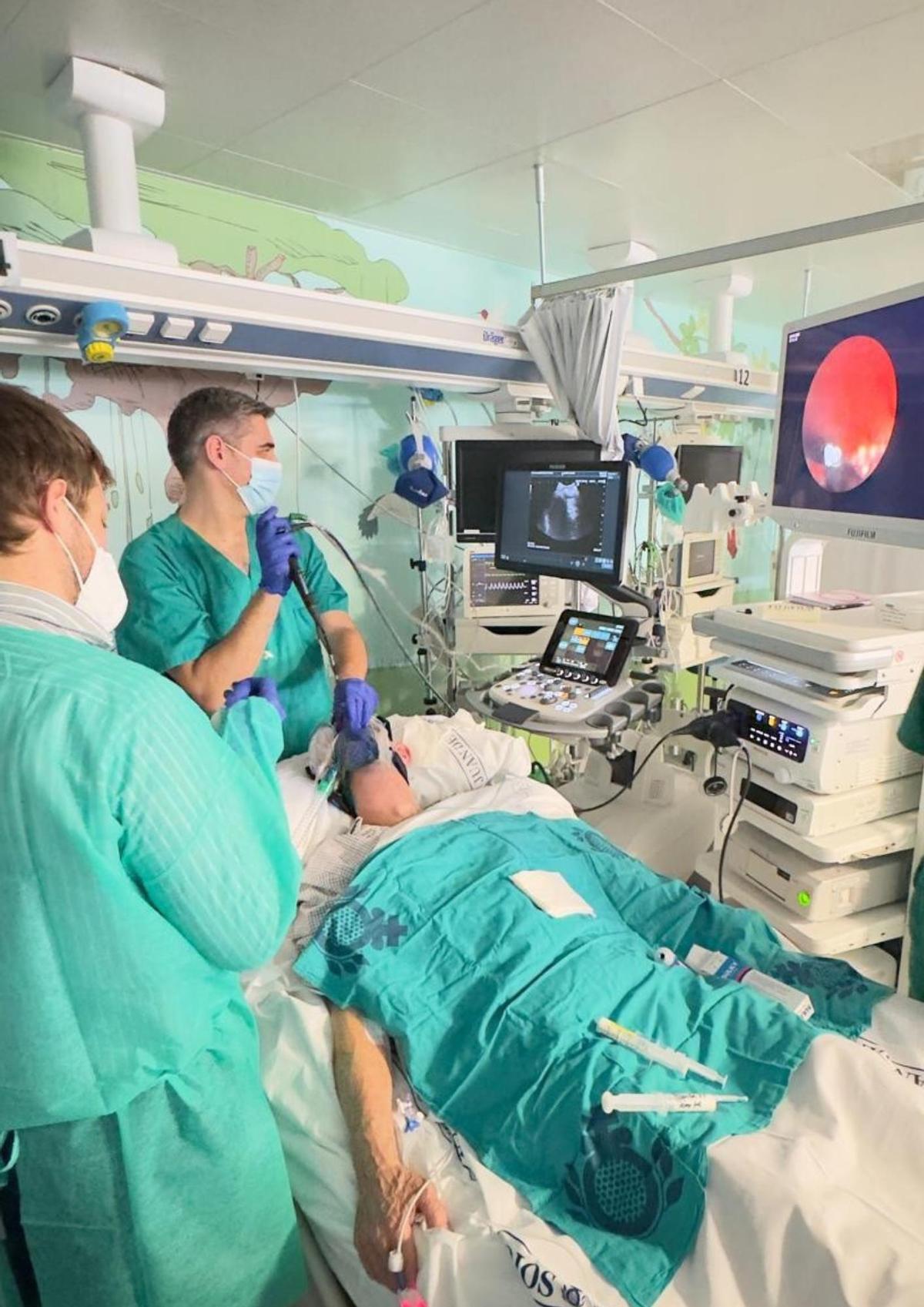 Un paciente durante la realización de la ecobroncoscopia