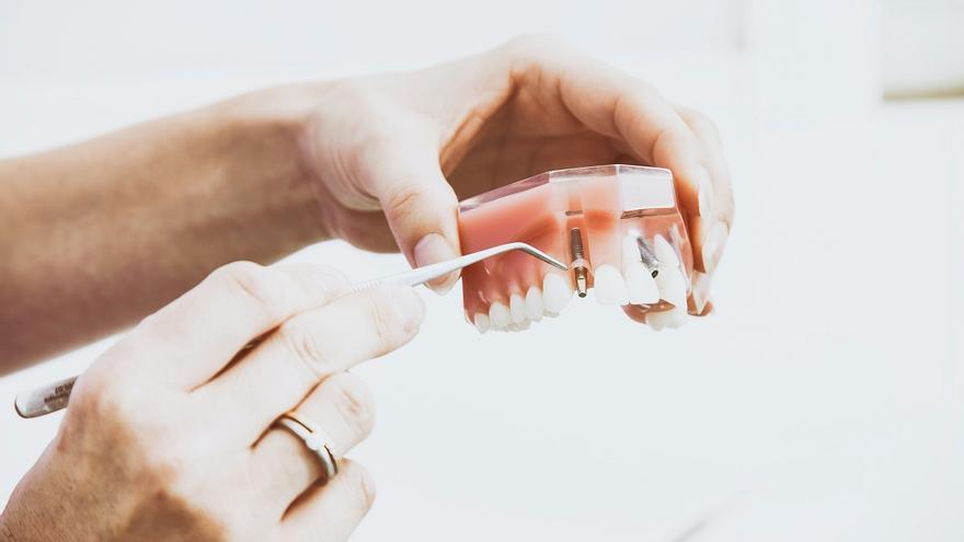 Todo lo que debemos saber sobre los implantes dentales, en 10 preguntas