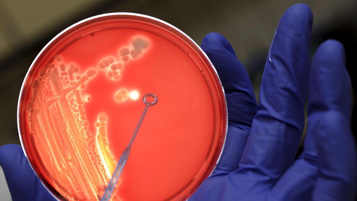 Un asistente de laboratorio examina una colonia de bacterias Escherichia coli en un cultivo