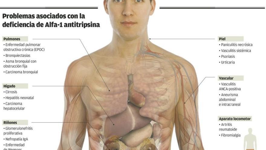 Alfa-1, la proteína que promete grandes remedios