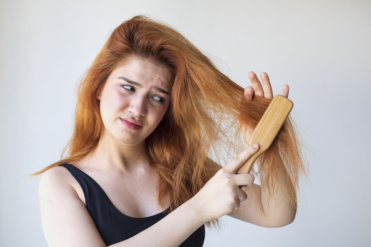 La pérdida de cabello atrae una sensación negativa.