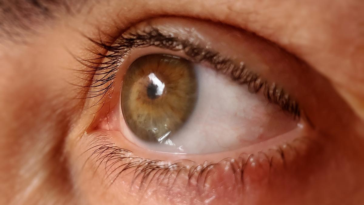 Este sábado se celebra el Día mundial contra el glaucoma.