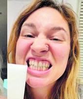 Una usuaria se blanquean los dientes con goma mágica. | TikTok