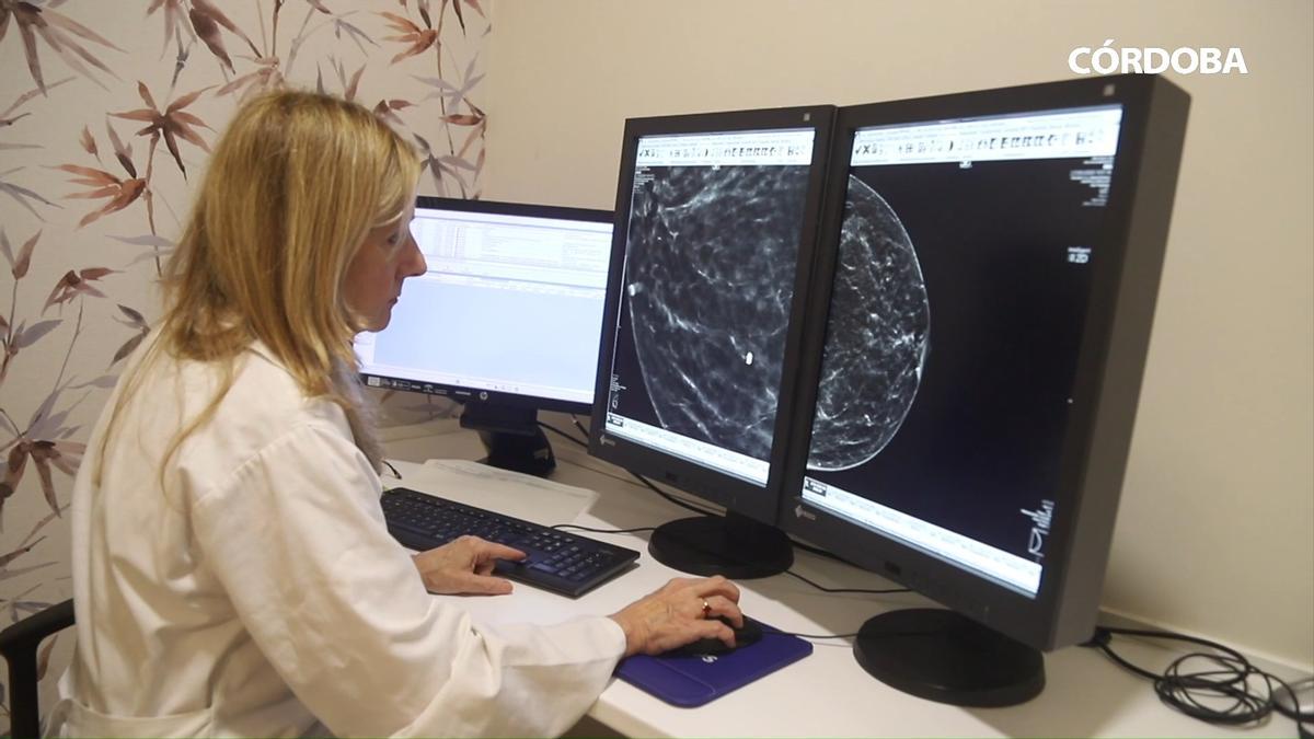 Marina Álvarez, jefa de la unidad de radiodiagnóstico del hospital Reina Sofía