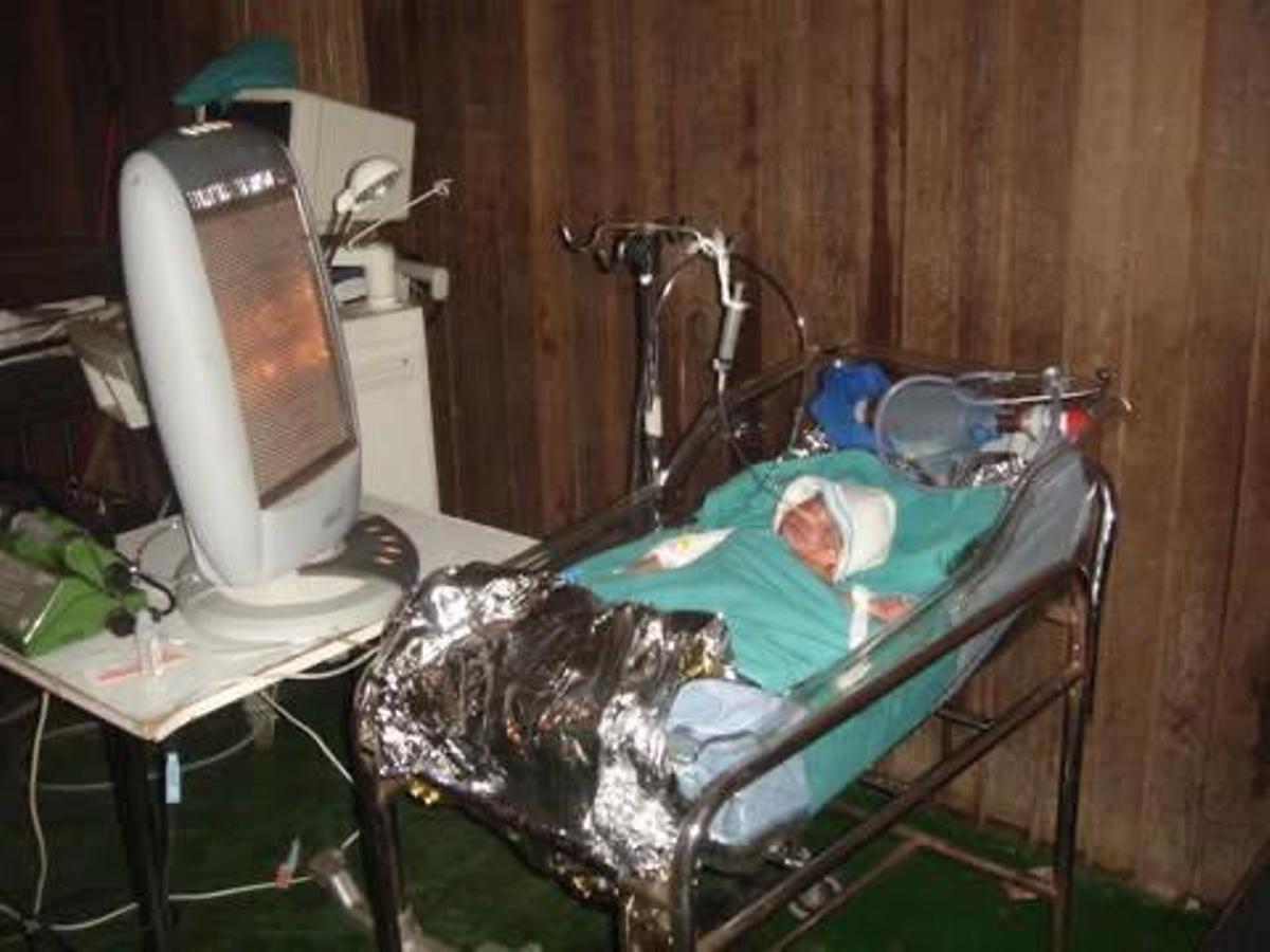 Un prematuro envuelto en papel de aluminio y situado cerca de una estufa porque en su hospital no hay incubadoras, en Camerún.